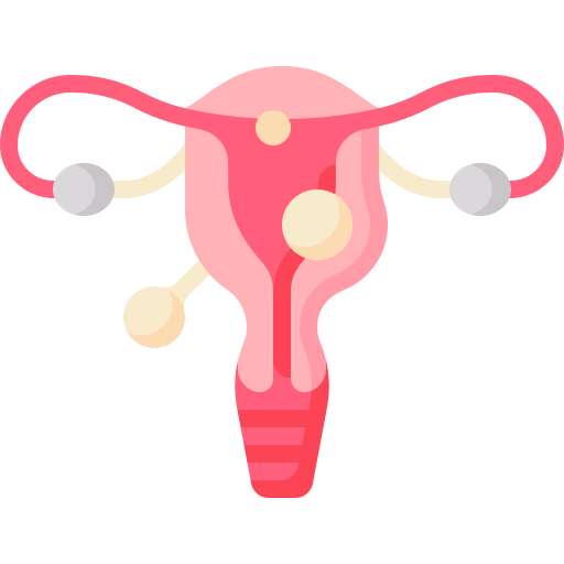 Fibroid